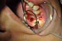 %_tempFileNameImplant%2091a4%