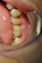 %_tempFileNameImplant%2091b1%