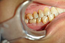 %_tempFileNameImplant%2091b2%
