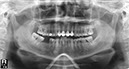 %_tempFileNameImplant%2091c1%