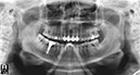 %_tempFileNameImplant%2091c2%