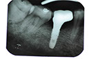 %_tempFileNameImplant%2091c3%