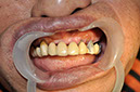 %_tempFileNameImplant%2092Ua1%