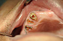 %_tempFileNameImplant%2092Ub1%