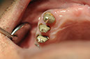 %_tempFileNameImplant%2092Ub2%