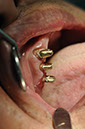%_tempFileNameImplant%2092Ub3%
