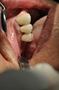 %_tempFileNameImplant%2092Uc1%