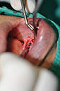 %_tempFileNameImplant%2092a6%