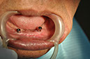 %_tempFileNameImplant%2092b3%