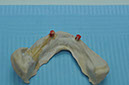 %_tempFileNameImplant%2092b4%
