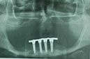 %_tempFileNameImplant%2092c3%20(1)%