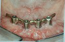 %_tempFileNameImplant%2092c3%20(2)%