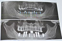 %_tempFileNameImplant%2092c3(3)%