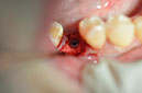 %_tempFileNameImplant%2093c3%