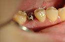 %_tempFileNameImplant%2093c4%
