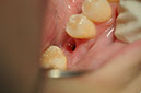 %_tempFileNameImplant%2093c5%