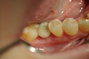 %_tempFileNameImplant%2093d2%