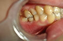 %_tempFileNameImplant%2093d3%