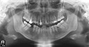 %_tempFileNameImplant%2093e1%