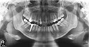 %_tempFileNameImplant%2093e2%