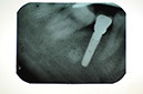 %_tempFileNameImplant%2093e3%