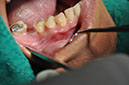 %_tempFileNameImplant%2094a1%