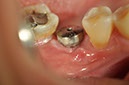 %_tempFileNameImplant%2094b1%