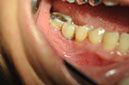 %_tempFileNameImplant%2094c1%