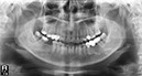%_tempFileNameImplant%2094d1%