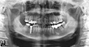 %_tempFileNameImplant%2094d2%