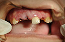 %_tempFileNameImplant%2095a1%