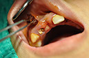 %_tempFileNameImplant%2095a2%