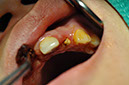 %_tempFileNameImplant%2095a3%