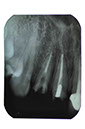 %_tempFileNameImplant%2095a4%