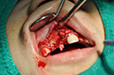 %_tempFileNameImplant%2095b1%