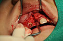%_tempFileNameImplant%2095b2%