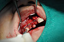 %_tempFileNameImplant%2095b3%