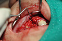 %_tempFileNameImplant%2095b4%