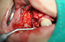 %_tempFileNameImplant%2095b5%