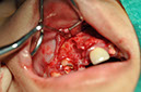 %_tempFileNameImplant%2095b6%