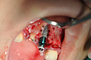 %_tempFileNameImplant%2095c1%