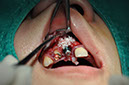 %_tempFileNameImplant%2095c2%