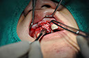 %_tempFileNameImplant%2095c3%