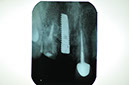 %_tempFileNameImplant%2095c4%