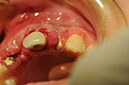 %_tempFileNameImplant%2095c6%