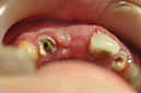 %_tempFileNameImplant%2095d1%