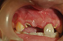 %_tempFileNameImplant%2095d2%