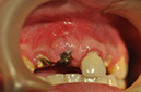 %_tempFileNameImplant%2095d3%