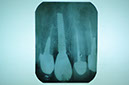 %_tempFileNameImplant%2095d4%