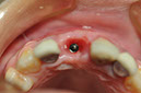 %_tempFileNameImplant%2095d5%